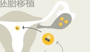 南宁最大的助孕机构是哪家？南宁三大助孕机构介绍